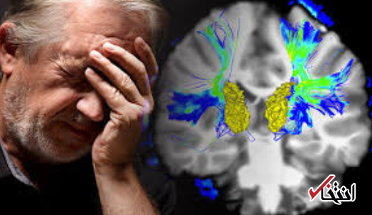 ورزش بوکس باعث پارکینسون می شود؟