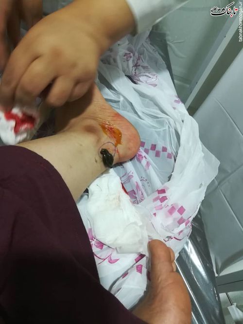 آیا صحیح است، که با انداختن &laquo;زالو&raquo; به جان مردم کسب درآمد کنند؟