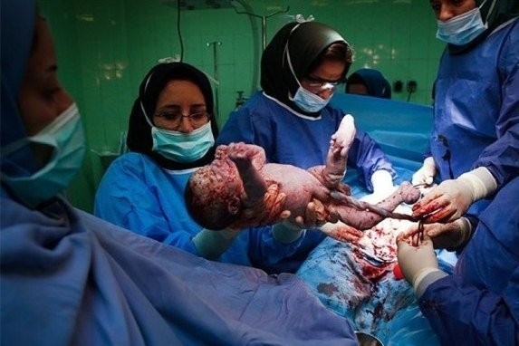 زائو زایمان می&zwnj;کند، ماما کمک می&zwnj;کند، پولش را متخصّص زنان و زایمان می&zwnj;گیرد !؟