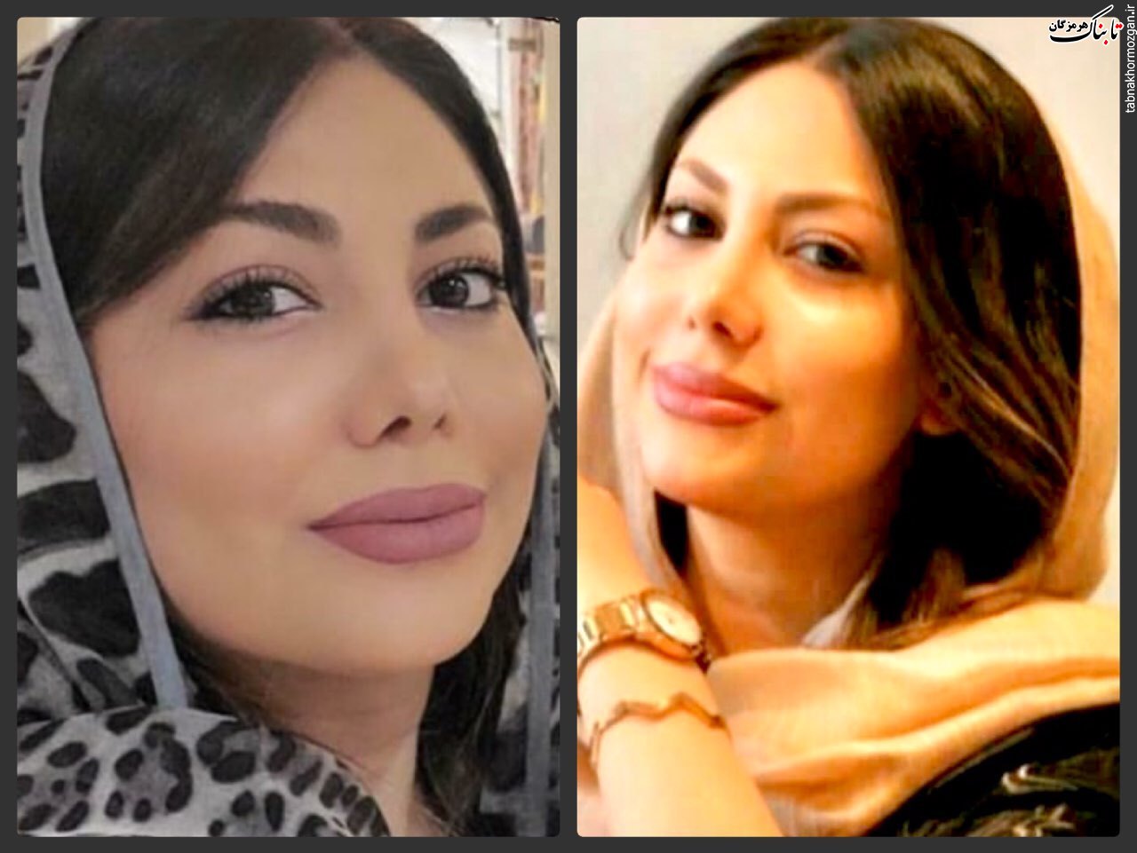 محدثه رضی کارشناس اتاق عمل به دنبال حادثه انفجار شب گذشته در کلینیک جراحی سینا مهر شمیران درگذشت