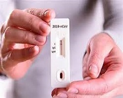 ساخت کیت ارزان قیمت تشخیص کرونا در 15 دقیقه