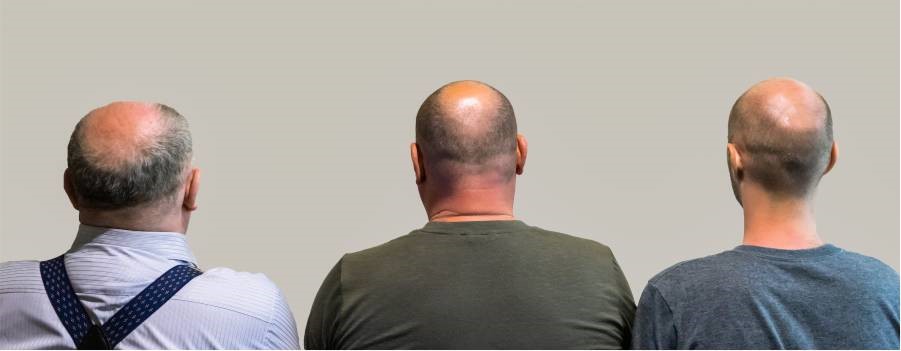 بهترین مرکز انجام کاشت مو و کاشت ابرو در تهران کجاست؟ بهترین مرکز انجام کاشت مو و کاشت ابرو در تهران کجاست؟