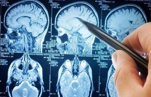 بهترین پزشکان مغز و اعصاب دنیا بهترین پزشکان مغز و اعصاب دنیا