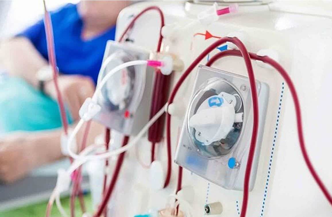 ارتقای خدمات دیالیز هرمزگان با ورود ۸۰ دستگاه جدید ارتقای خدمات دیالیز هرمزگان با ورود ۸۰ دستگاه جدید