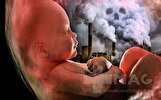 آلودگی هوا تهدیدی خاموش برای مادر و جنین